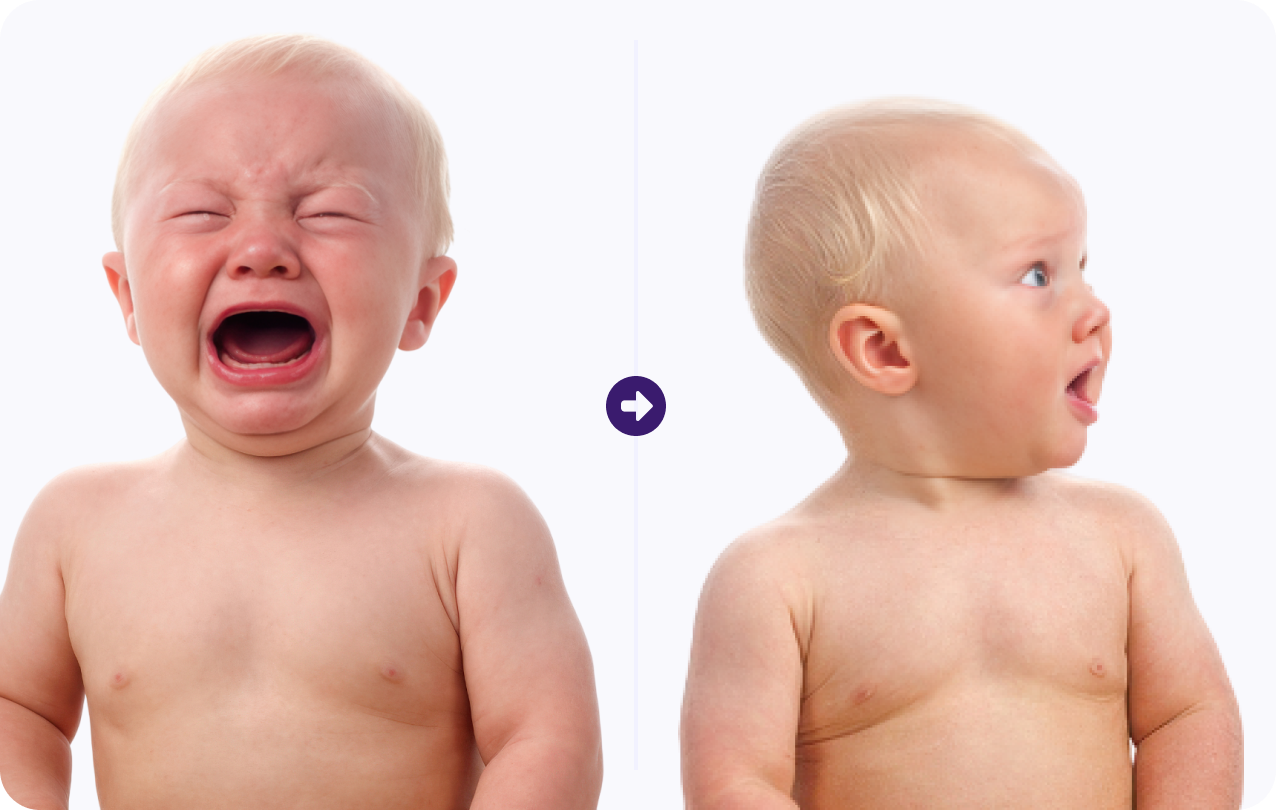 Before and After